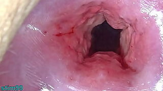 Janique gyno exam